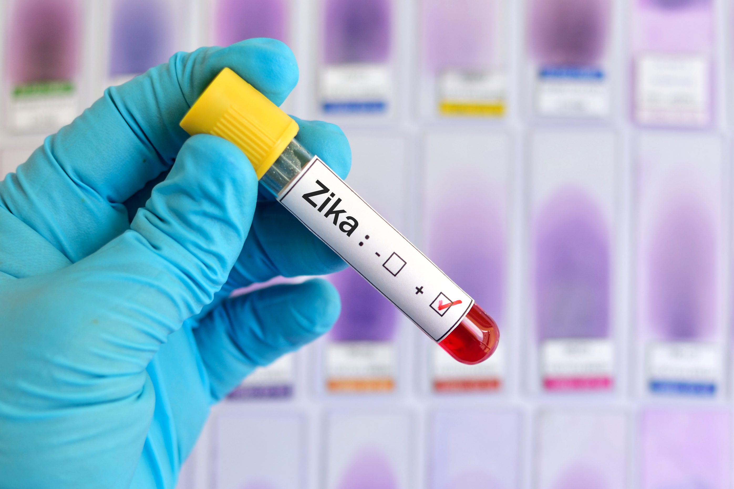 Zika virus positive Zika scam
